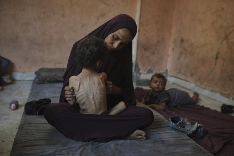 Dozens of kids and adults in Gaza have starved to death in July as hunger surges