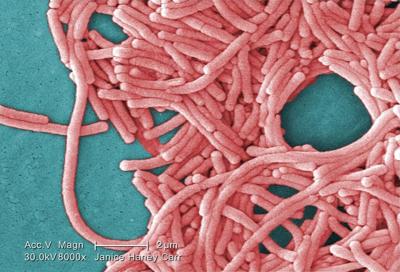Nova Scotia health officials say legionella outbreak in New Glasgow considered over