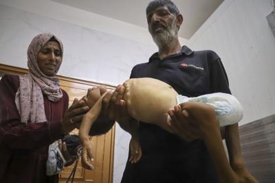 Malnourished kids arrive daily at a Gaza hospital as Netanyahu denies hunger