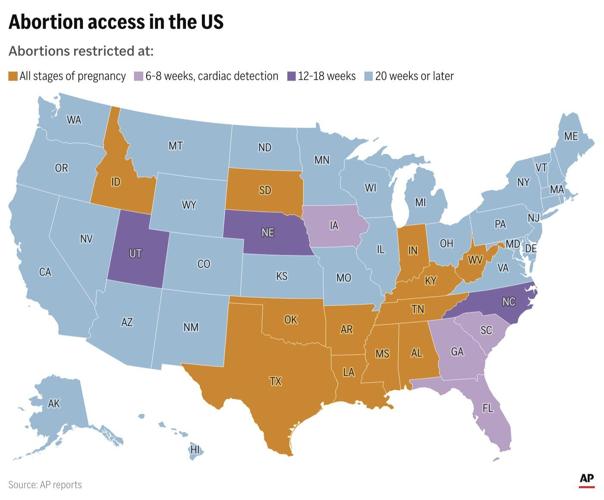 South Carolina Supreme Court decides heartbeat definition allows six-week abortion ban