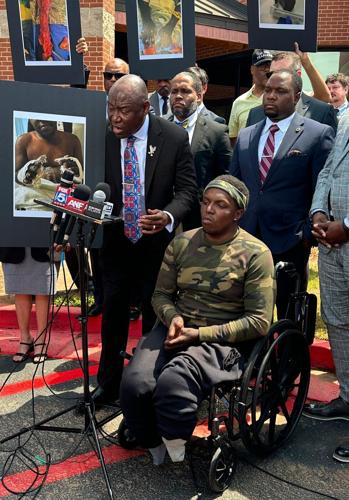 Man says severe medical neglect at problem-plagued jail in Atlanta resulted in amputations