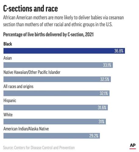Why do so many Black women die in pregnancy? One reason: Doctors don't take them seriously