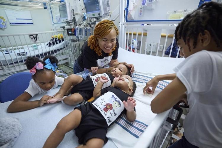 Twin boys born conjoined celebrate 1st birthday after separation surgery