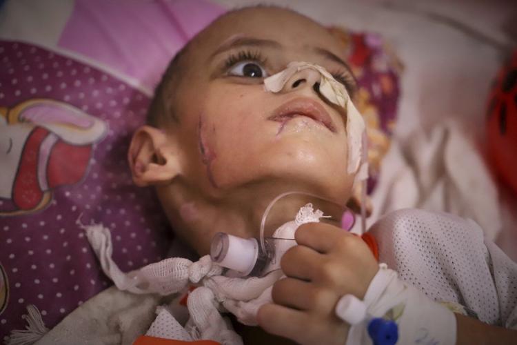 A boy in Gaza with brain damage fights for his life amid blockade