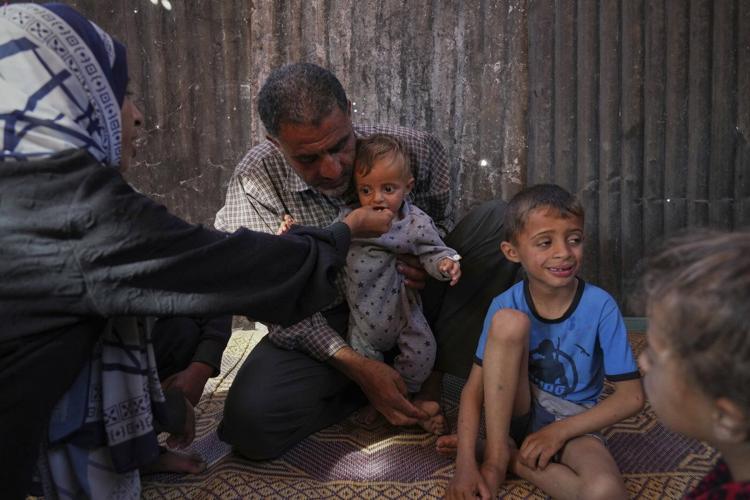 Takeaways from AP's reporting on child malnutrition in Gaza