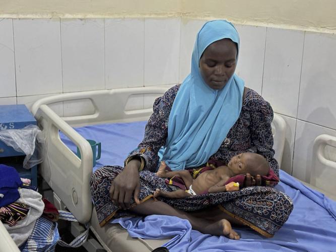 Children die as USAID aid cuts snap a lifeline for the world's most malnourished