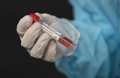 Canada's first case of new COVID variant is detected in B.C.