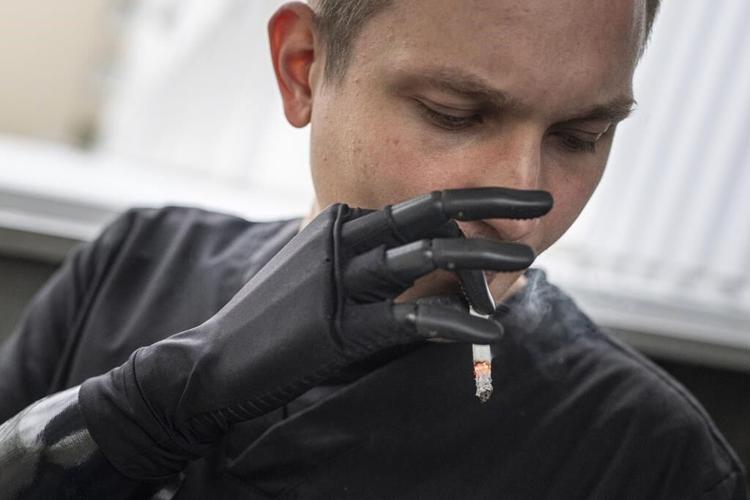The war took away their limbs. Now bionic prostheses empower wounded Ukrainian soldiers