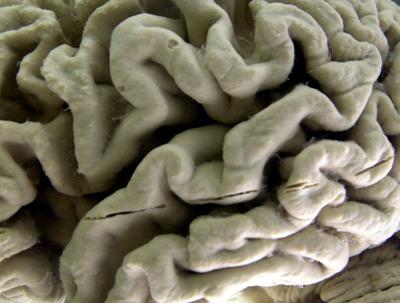 Study shows a blood test can help identify healthy people at high risk for Alzheimer's disease