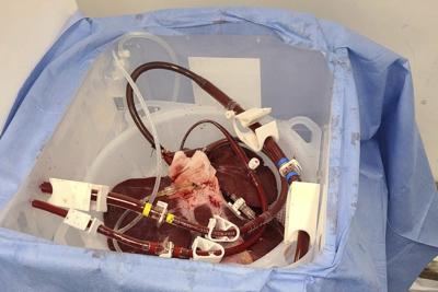 Behind the story of the decades-long journey of xenotransplantation