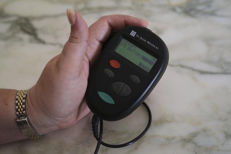 NIH cuts spotlight a hidden crisis facing patients with experimental brain implants