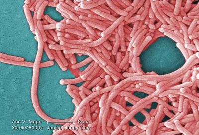 One dead, dozens sick in legionnaires' disease outbreak in London, Ont.: health unit