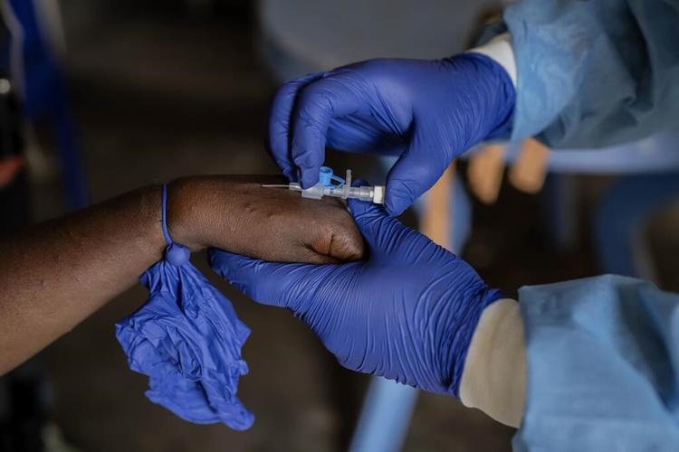 WHO says mpox cases in Congo's epicenter where the new variant was detected may be 'plateauing'
