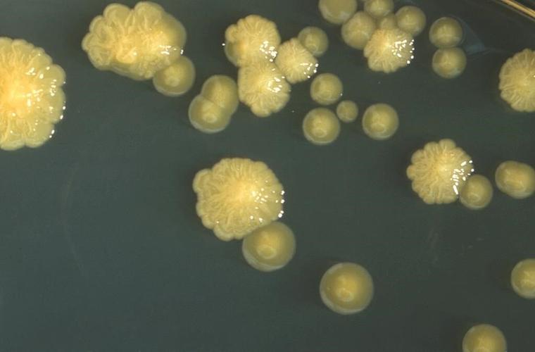 Deadly germ behind infant formula shortage joins CDC watchlist of bad bugs