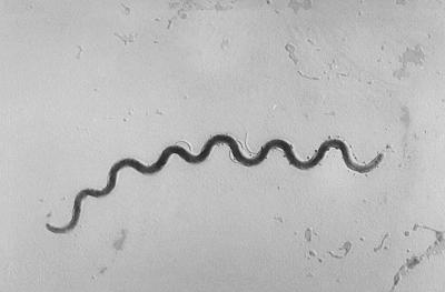 As syphilis cases among US newborns soar, doctors group advises more screening during pregnancy