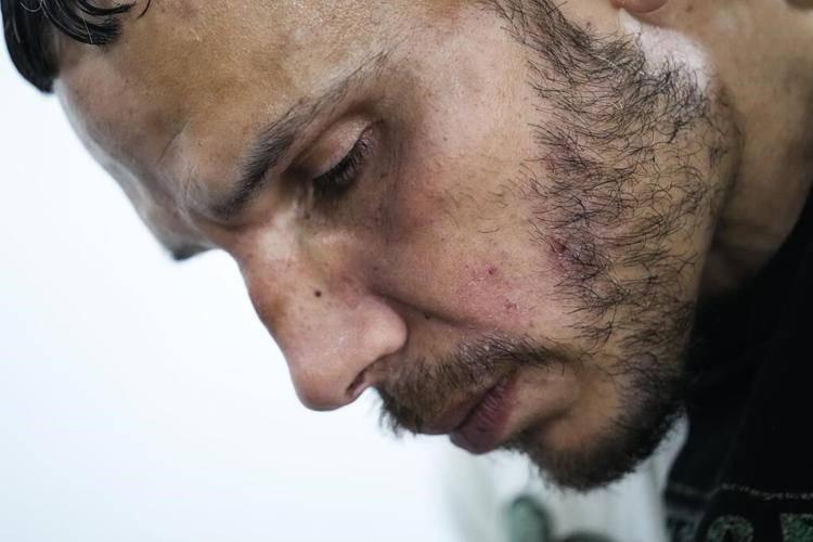 Animal sedative adds new suffering to opioid drug crisis, but is it driving up deaths?