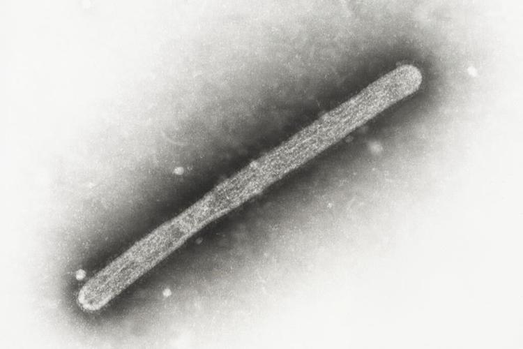 CDC calls for expanded testing for bird flu after blood tests reveal more farmworker infections