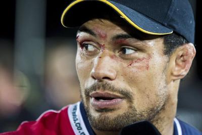 Ex-rugby player Shane Christie, who called for study of concussion, dies at age 39