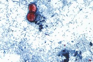 Foodborne illnesses at restaurant chains are rare but can sicken customers