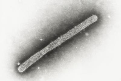 Michigan farmworker diagnosed with bird flu, becoming 2nd US case tied to dairy cows