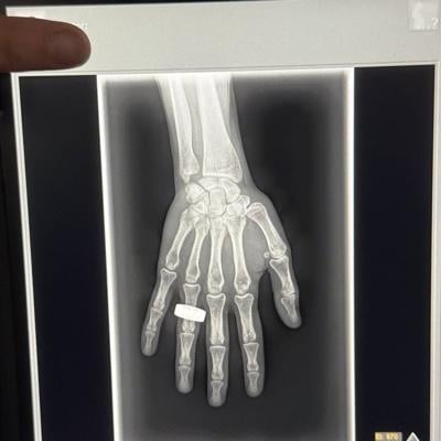 ɫtv firm KA Imaging claims first X-ray image taken in space