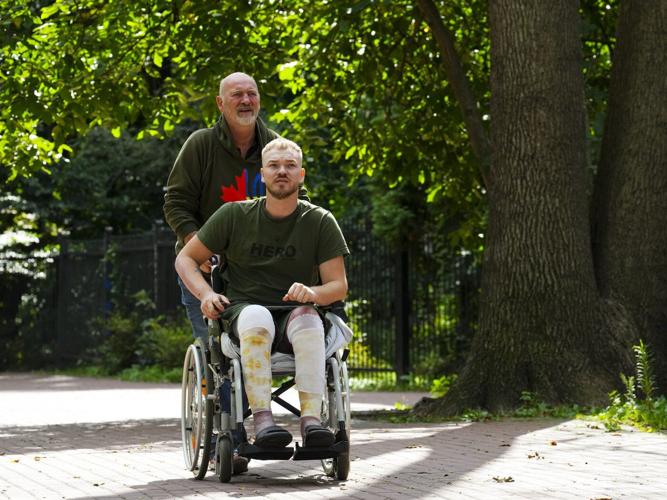 'Just shoot me': Calgarian fighting in Ukraine in painful recovery after drone attack