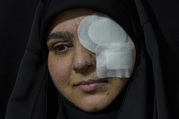 PHOTO ESSAY: Portraits of survivors of Israel's pager attack on Hezbollah last year