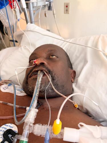 Haitian man dies in US immigration custody with untreated toothache, brother says