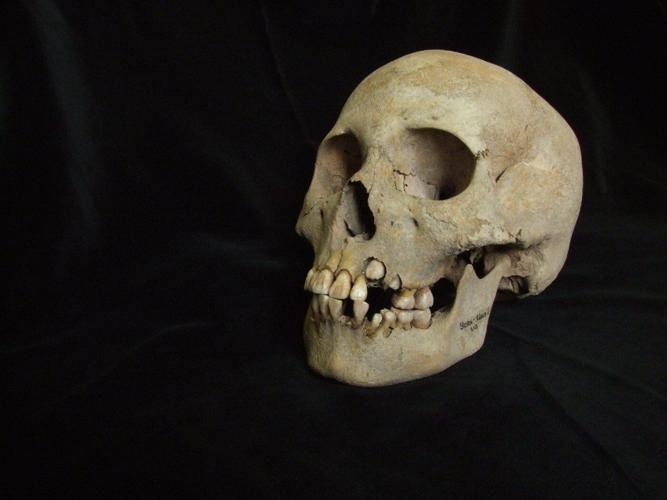 Ancient teeth from Siberia rewrite the plague’s timeline, dating back to over 5,500 years ago