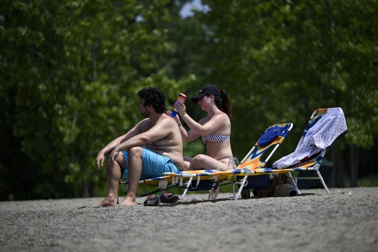 Melanoma is on the rise and young people aren't using enough sunscreen, doctors say