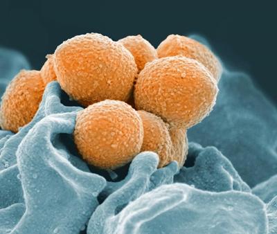 Get flu shot to limit risk of rare cases of invasive, deadly strep A: doctor