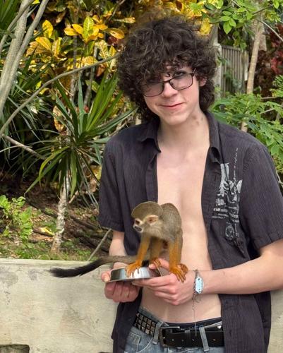 Edmonton man brain-injured in Caribbean bar attack back home but missing skull piece