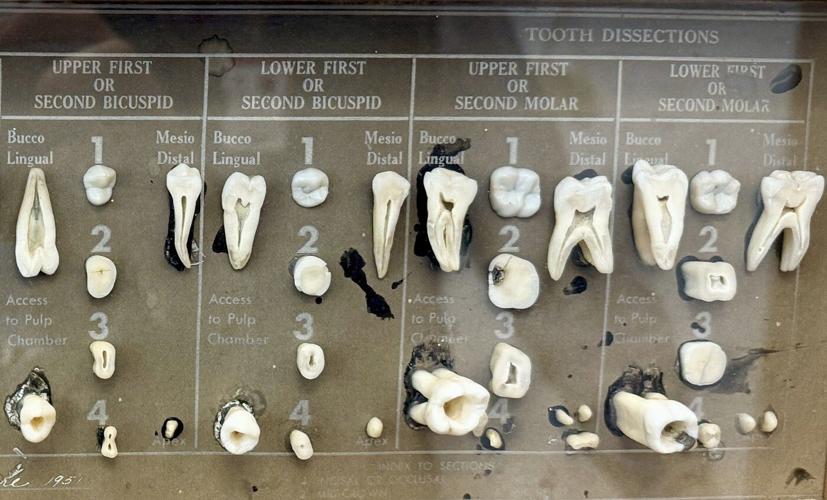 How Utah dentists are preparing patients for the first statewide fluoride ban