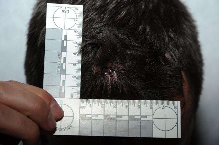 VPD officers haven't spoken at Myles Gray death hearing. Here's what the exhibits say