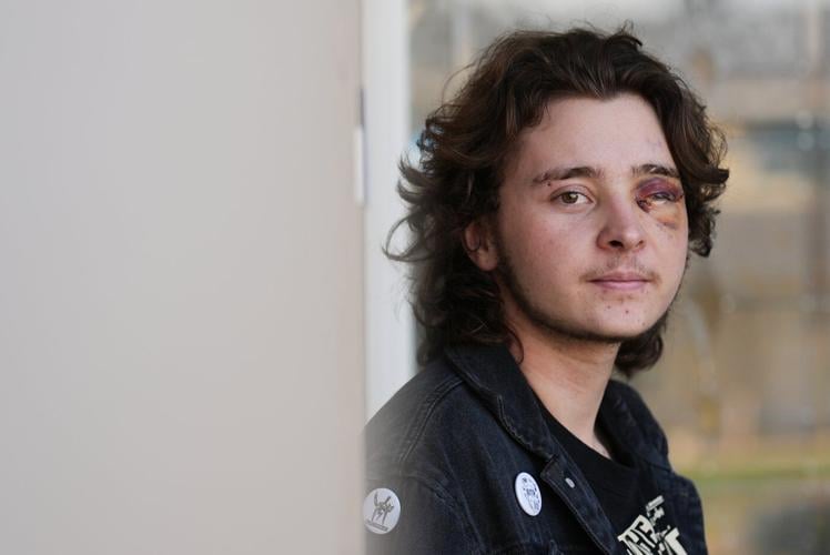 California protester left blind in one eye is among string of violent run-ins with federal agents