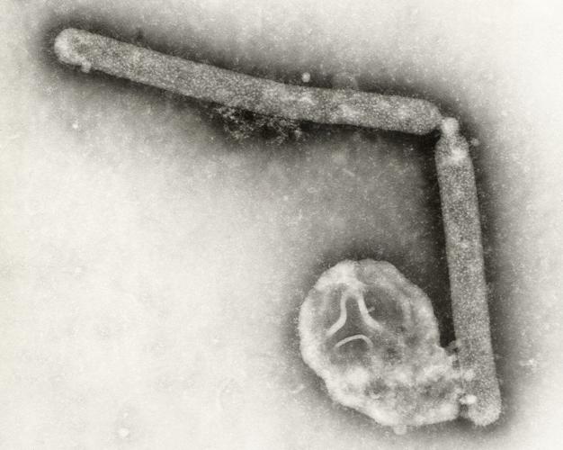 The US hasn't seen a human bird flu case in 3 months. Experts are wondering why