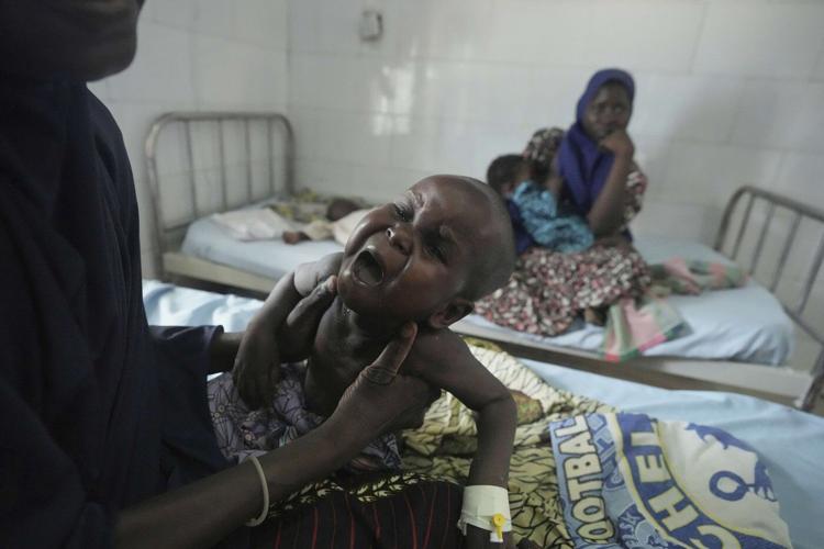 Children die as USAID aid cuts snap a lifeline for the world's most malnourished