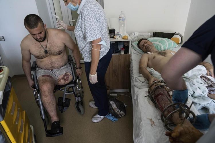Upward of 20,000 Ukrainian amputees face trauma on a scale unseen since WWI