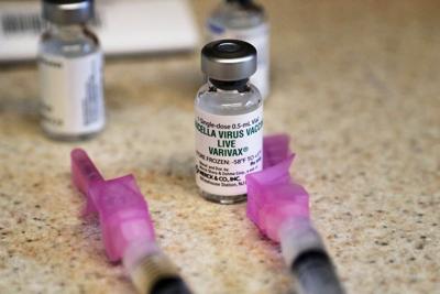 UK experts recommend chickenpox shot for kids for the first time, decades after other countries