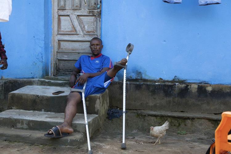 'We fall and we rise': Some amputees in Sierra Leone turn to farming to combat discrimination