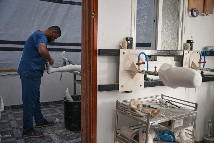 Gaza amputees struggle to rebuild lives as the enclave faces shortages of prosthetic limbs