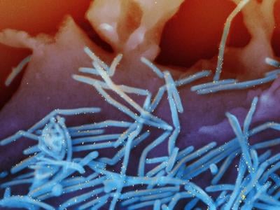 Le CCNI recommande un programme de vaccination contre le VRS pour les nourrissons