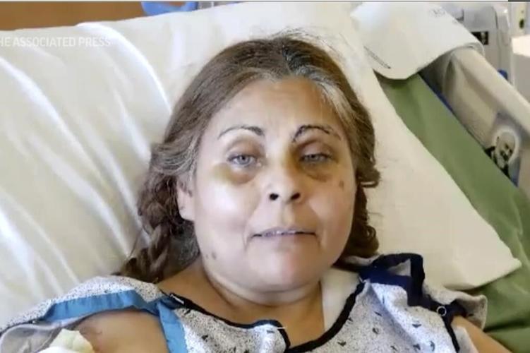 Factory explosion survivor, on fire, fell into chocolate vat