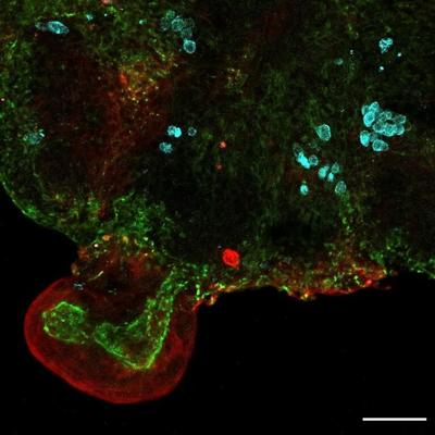 Scientists have used cells from fluid drawn during pregnancy to grow mini lungs and other organs
