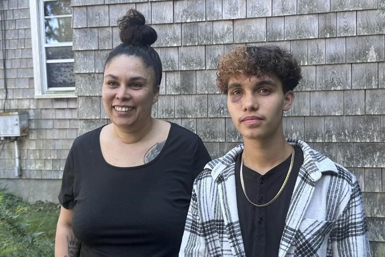 A transgender teen in Massachusetts says other high schoolers beat him at a party