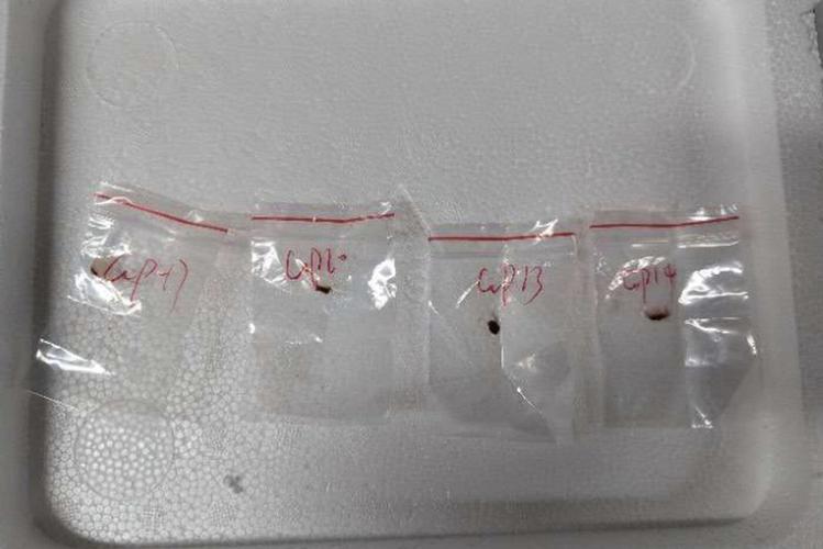 Lawyers say plea deal is being pursued for Chinese scientist charged in US toxic fungus case