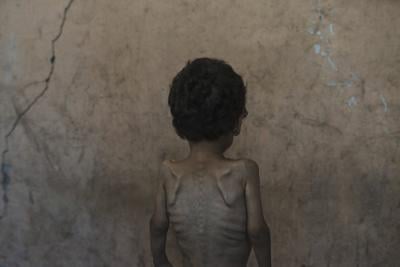 'Worst-case scenario of famine' is happening in Gaza, food crisis experts say