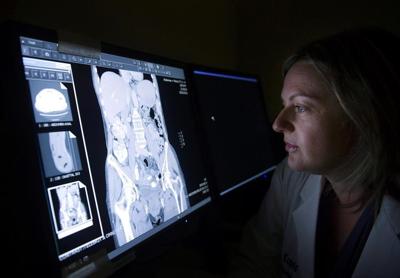 Des groupes réclament de meilleures données sur le cancer