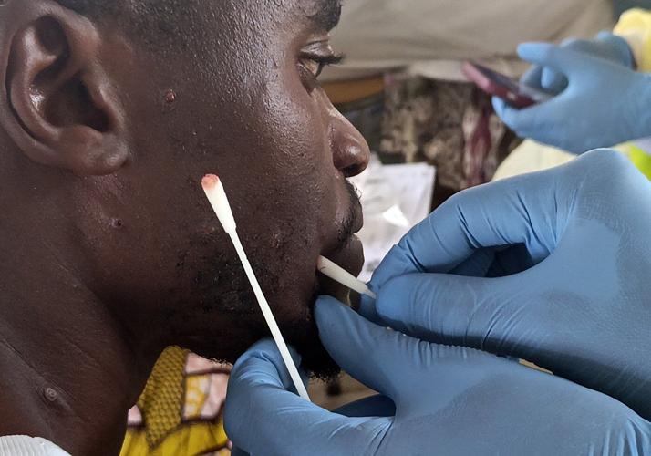US aid cuts are hurting Africa's ability to respond to disease outbreaks, health chief says
