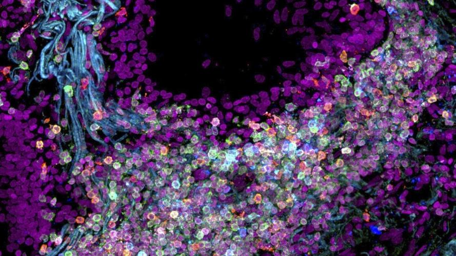 Scientists map out the human body one cell at a time